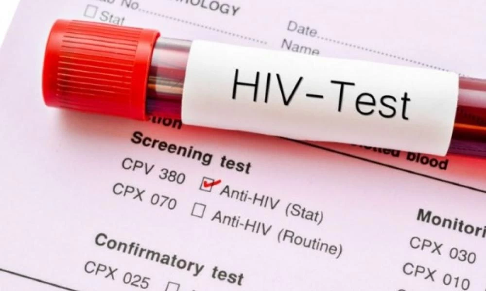 Εντοπίστηκε καταγωγή του AIDS – Βρέθηκε ο “ασθενής-μηδέν”